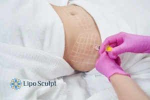 Are The Results From Aqualyx Permanent? 1 Do you want to know how long Aqualyx Winslow results last?