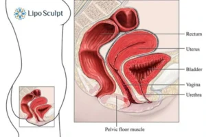 Treatment For A Leaky Bladder 2 How EM Chair treatment Winslow can help Leaky bladder issues. Read more now!