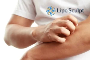 Best Actinic Keratoses Removal 4 prevent your actinic keratoses Winslow getting worse - call our team today!