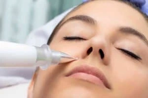 Best Actinic Keratoses Removal 3 Actinic keratoses Winslow solutions - book in today!