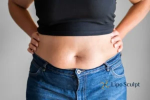 Bidding Farewell to Muffin Tops with Aqualyx Fat Injections 2 Do you wish you could reduce your muffin top Winslow With Aqualy fat dissolving injections you can!